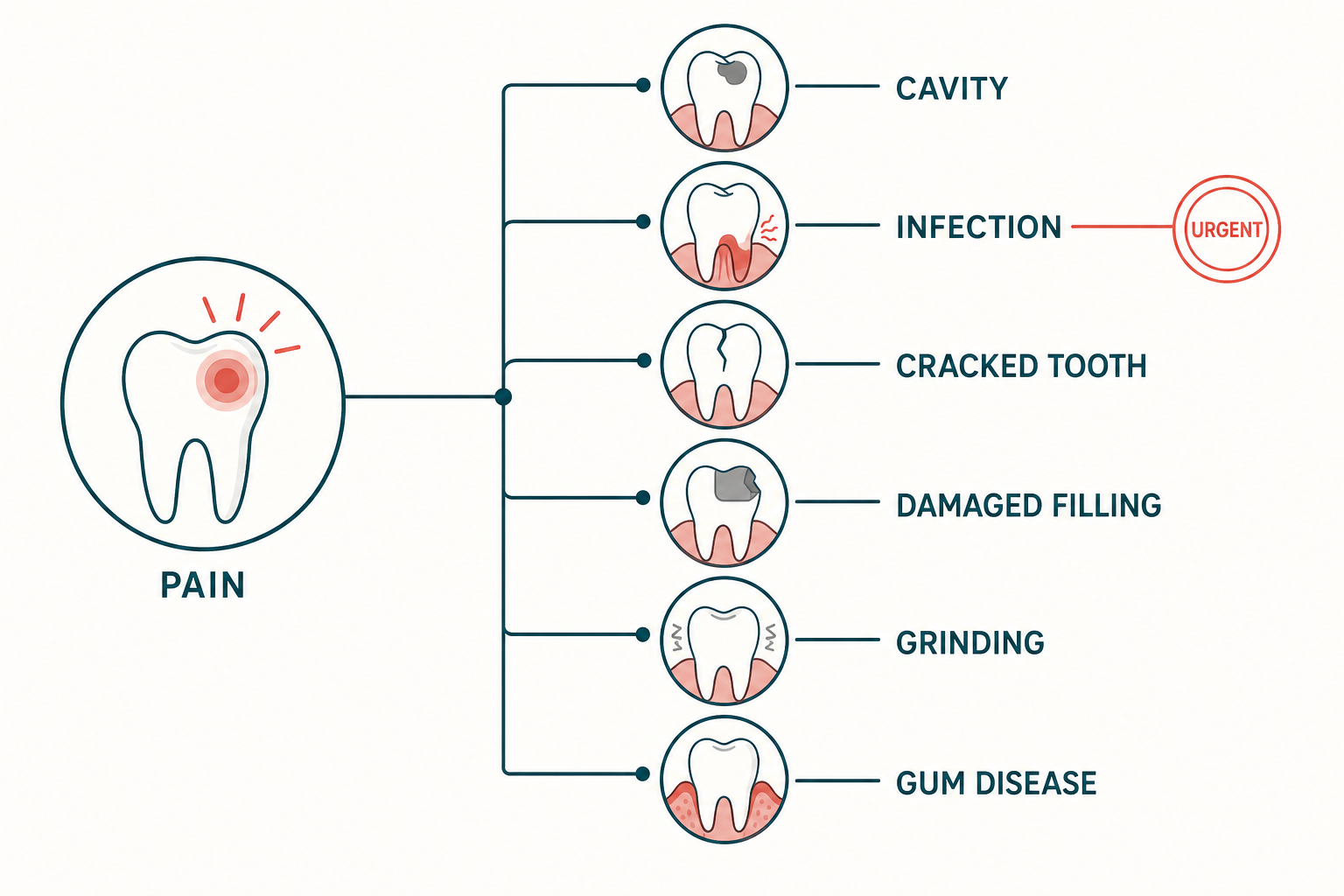 Dental Teeth Pain: When to Call Today 1 Branching diagram links tooth pain to cavity, infection, cracked tooth, damaged filling, grinding, and gum disease.
